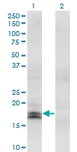 H00003440-M32 - IFNA2 / Interferon alpha-2