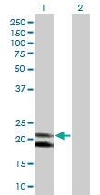 H00003441-D01P - IFNA4 / Interferon alpha-4