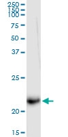 H00003442-D01 - IFNA5 / Interferon alpha-5