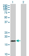 H00003451-B01 - IFNA17 / Interferon alpha-17