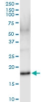 H00003451-D01 - IFNA17 / Interferon alpha-17