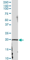 H00003452-D01 - IFNA21 / Interferon alpha-21