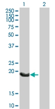 H00003512-B01P - Immunoglobulin J chain
