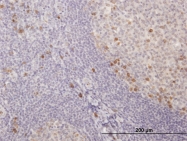 H00003514-B01 - IGKC