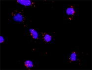 H00003552-D01P - Interleukin-1 alpha / IL-1A