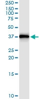 H00003553-D01 - Interleukin-1 beta / IL-1B