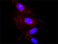 H00003553-D01P - Interleukin-1 beta / IL-1B