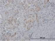 H00003569-B01P - Interleukin-6 / IL6