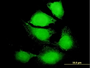 H00003569-B01P - Interleukin-6 / IL6