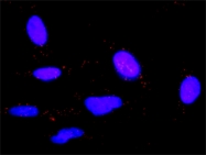 H00003569-D01P - Interleukin-6 / IL6