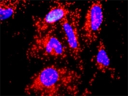 H00003586-D01P - Interleukin-10 / IL10