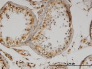 H00003596-M07 - Interleukin-13 / IL13