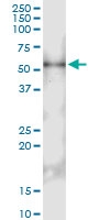 H00003598-D01 - CD213a2 / IL13RA2