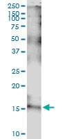H00003600-D01 - Interleukin-15 / IL15