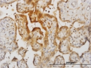H00003600-M13 - Interleukin-15 / IL15