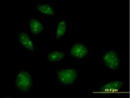 H00003603-D01P - Interleukin-16 / IL16