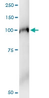 H00003609-D01 - ILF3 / DRBF