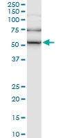 H00003611-M01 - Integrin-linked protein kinase