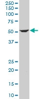 H00003611-M01 - Integrin-linked protein kinase