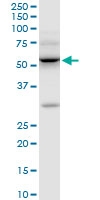 H00003611-M01 - Integrin-linked protein kinase
