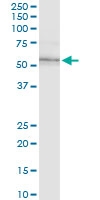 H00003611-M01 - Integrin-linked protein kinase