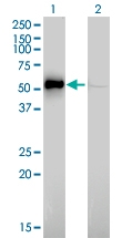 H00003611-M01 - Integrin-linked protein kinase