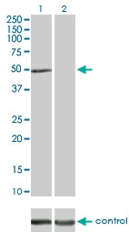 H00003611-M01 - Integrin-linked protein kinase