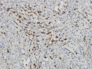 H00003620-M05 - IDO1 / INDO