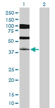 H00003651-D01P - Insulin promoter factor 1