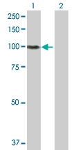 H00003693-D01P - Integrin beta-5 / ITGB5