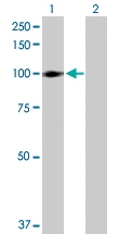 H00003694-D01P - Integrin beta-6 / ITGB6