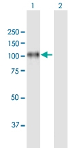 H00003696-B01P - Integrin beta-8 / ITGB8