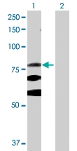 H00003696-D01P - Integrin beta-8 / ITGB8