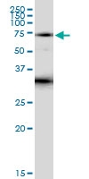 H00003702-D01 - Tyrosine-protein kinase ITK/TSK