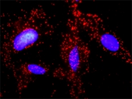 H00003728-D01P - Junction plakoglobin