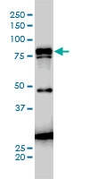 H00003728-M01 - Junction plakoglobin