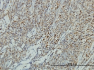 H00003728-M01 - Junction plakoglobin