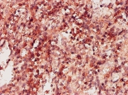 H00003795-M01 - Ketohexokinase