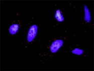 H00003815-M01 - CD117 / c-kit