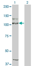 H00003815-M04 - CD117 / c-kit