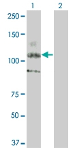 H00003815-M06 - CD117 / c-kit
