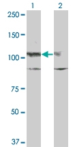 H00003815-M07 - CD117 / c-kit