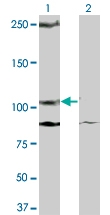 H00003815-M08 - CD117 / c-kit