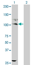 H00003815-M09 - CD117 / c-kit
