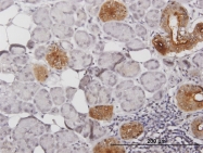H00003816-B01P - KLK1 / Kallikrein-1