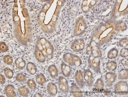 H00003817-B01 - KLK2 / Kallikrein-2