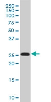 H00003821-A01 - KLRC1 / CD159a