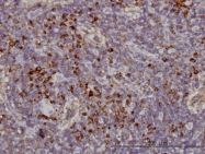 H00003833-M01 - KIFC1