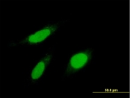 H00003836-B01P - KPNA1 / Importin alpha-1
