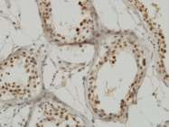 H00003836-M01 - KPNA1 / Importin alpha-1